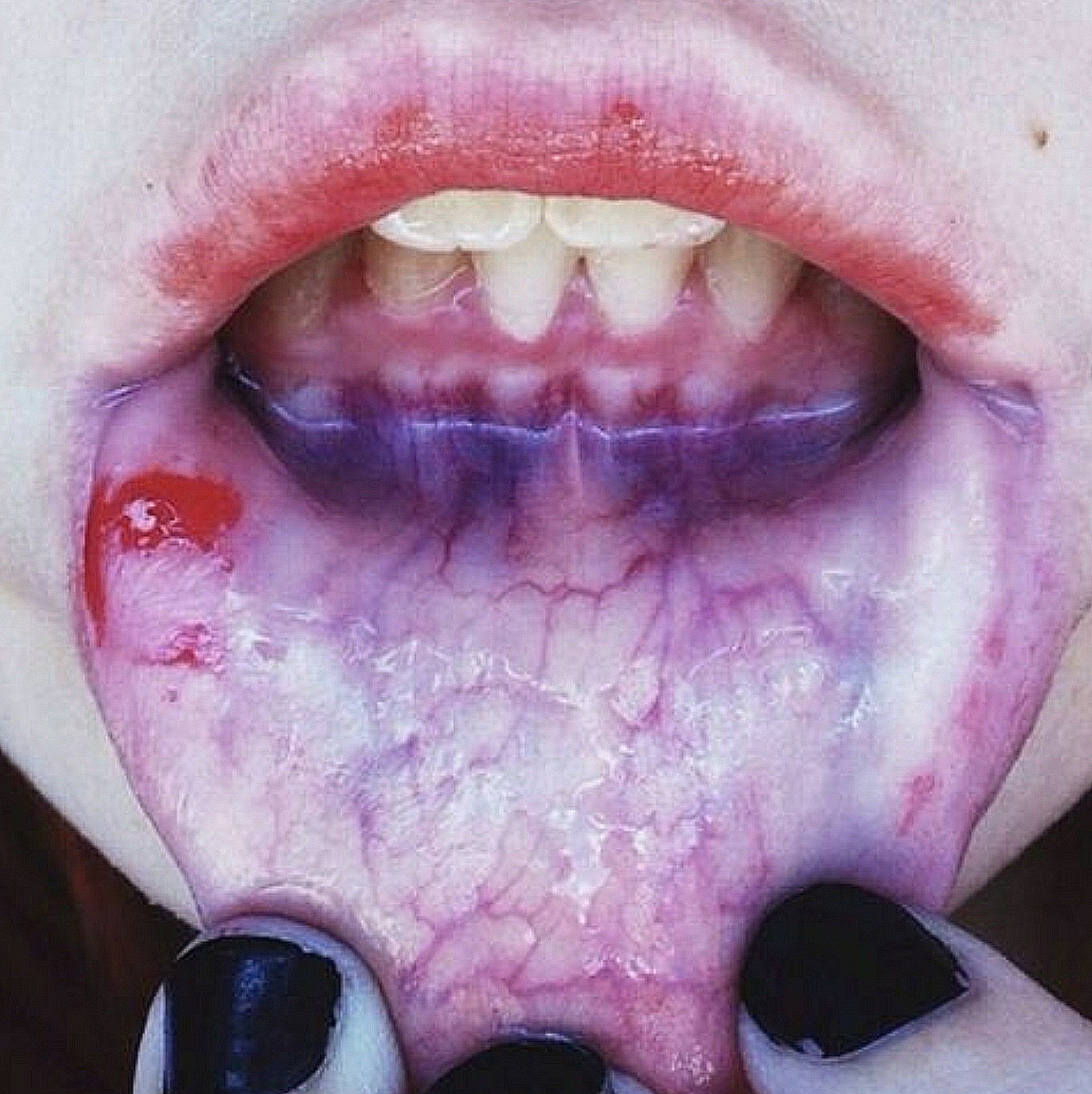 what�s good tumblr veins blood gore aesthetic cuts… what�s good tumblr veins blood gore aesthetic cuts…