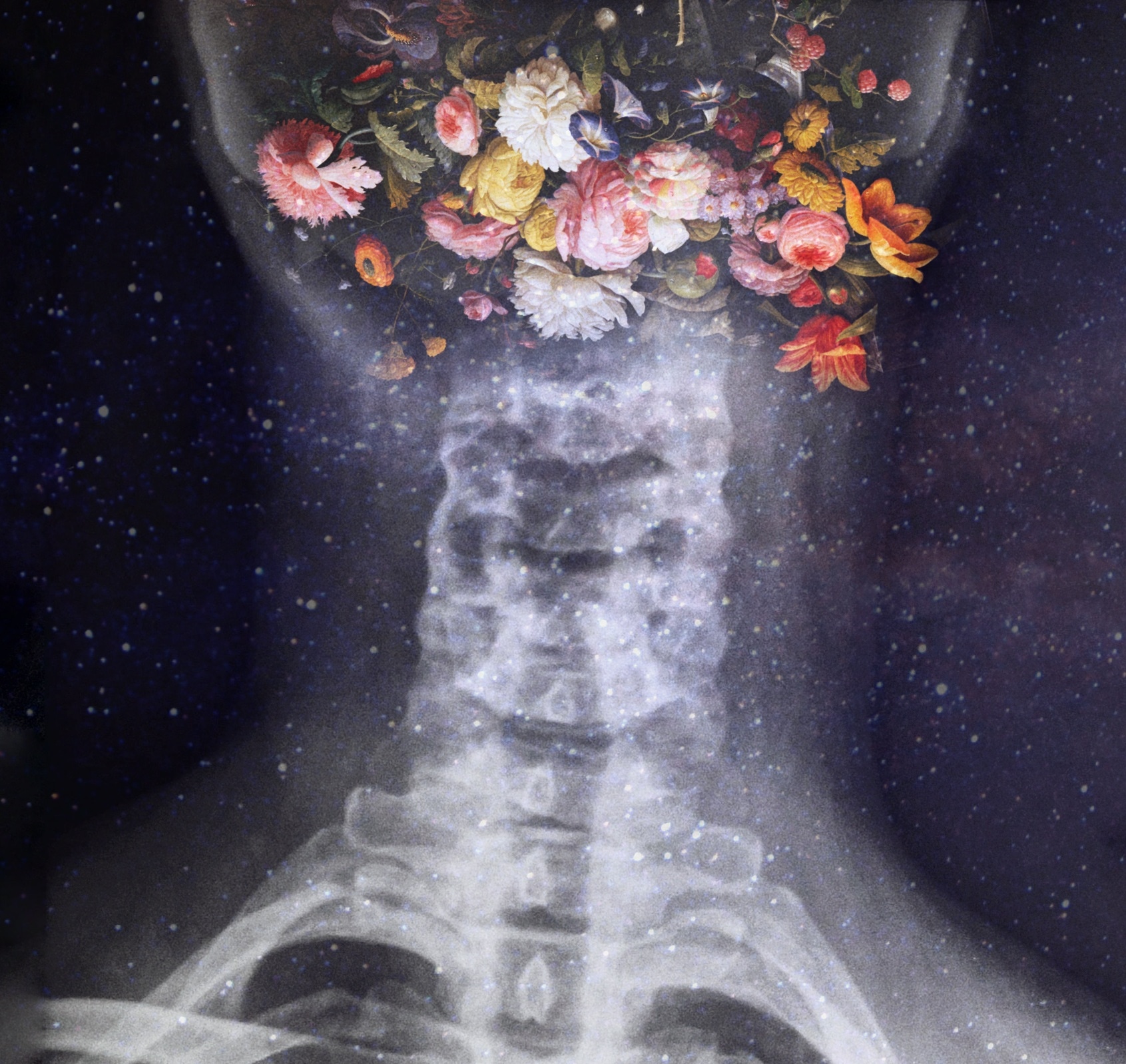 Bones 2. XRAY Flowers. Bones музыкант Эстетика. Рентген обои. Рентген Эстетика.