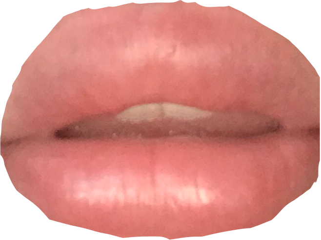 Freetoedit Lips Sticker By Lmaoireallyregrethis